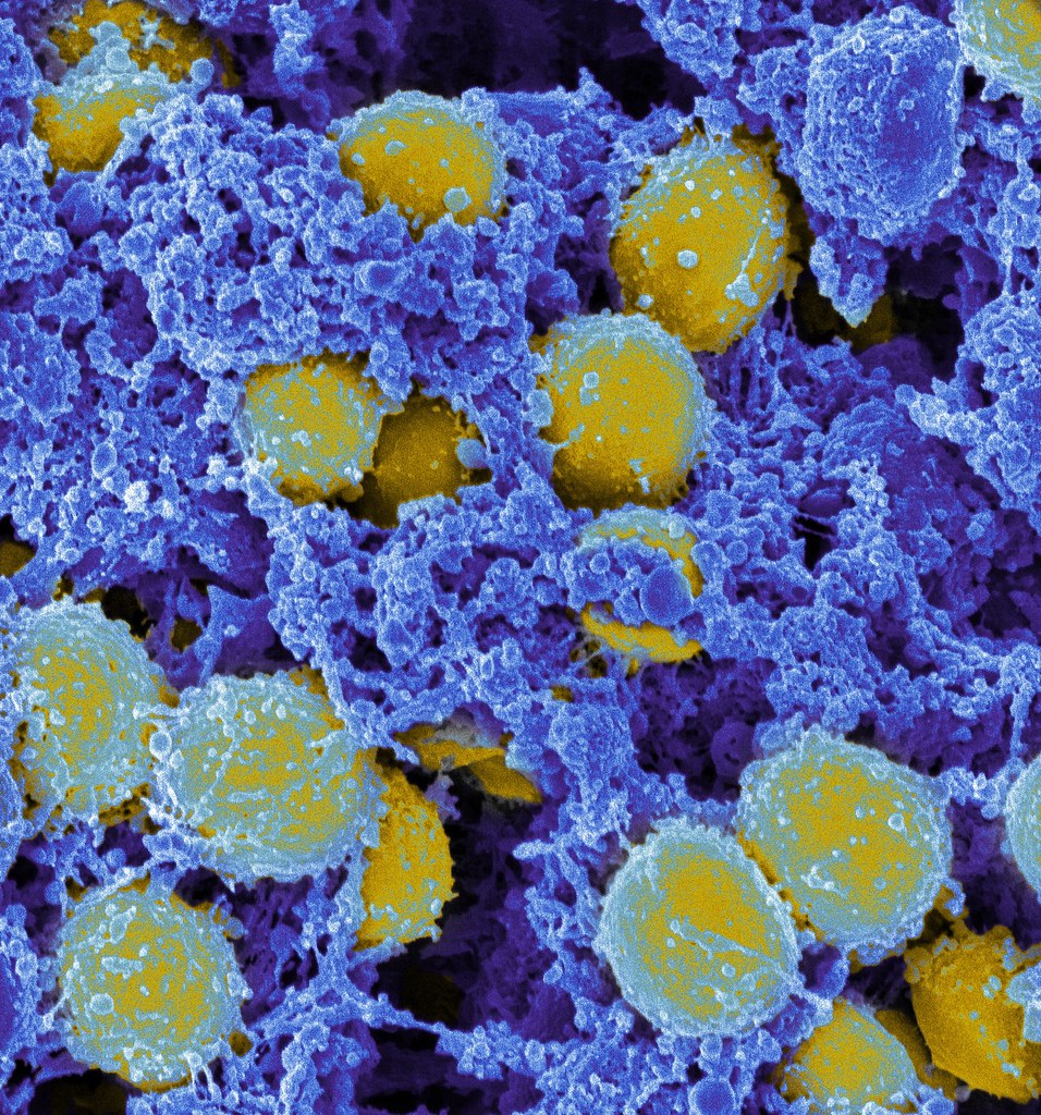 Imagen Staphylococcus